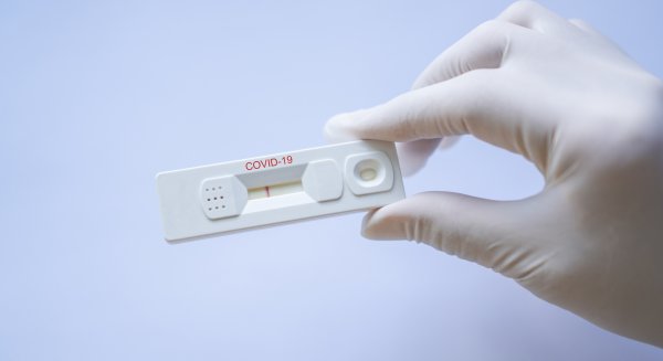 Málaga notifica 1.520 contagios y tres fallecidos por covid-19