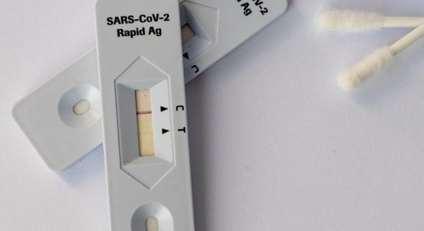 El Colegio de Farmacéuticos de Málaga informa del riesgo de los test covid en locales no autorizados