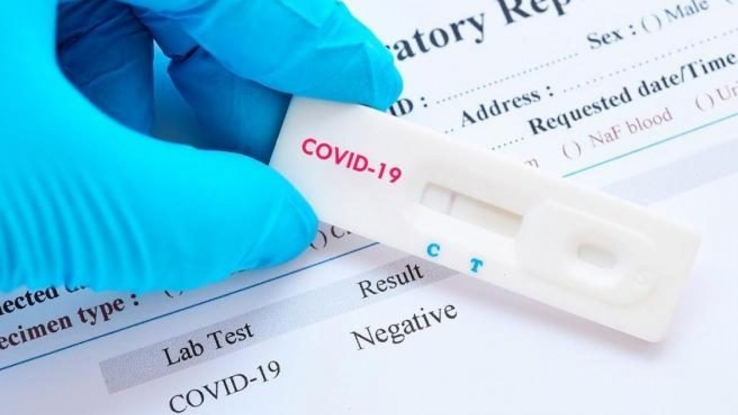La tasa de contagios por covid-19 desciende en Málaga