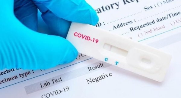 La tasa de contagios por covid-19 desciende en Málaga