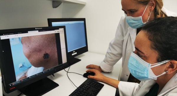 El impacto de la Covid 19 reduce en un 62% la detención precoz del melanoma en el Hospital Costa del Sol