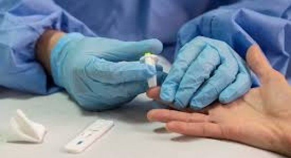Málaga registra 395 nuevos positivos por PCR y 135 curados en la última jornada
