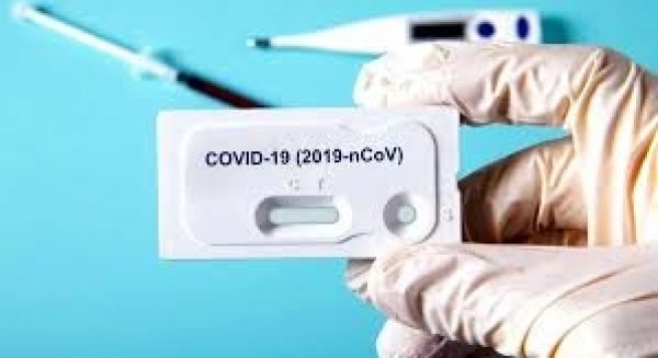 El Área Sanitaria de Málaga-Axarquía realiza 1.443 pruebas PCR en sus nueve 'auto-COVID'