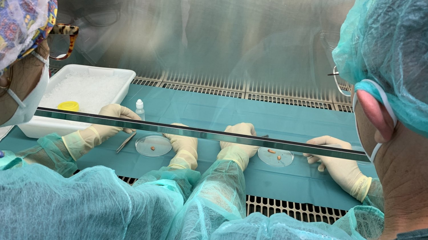 Profesionales del Materno Infantil extraen tejido ovárico de menores oncológicas para preservar su fertilidad
