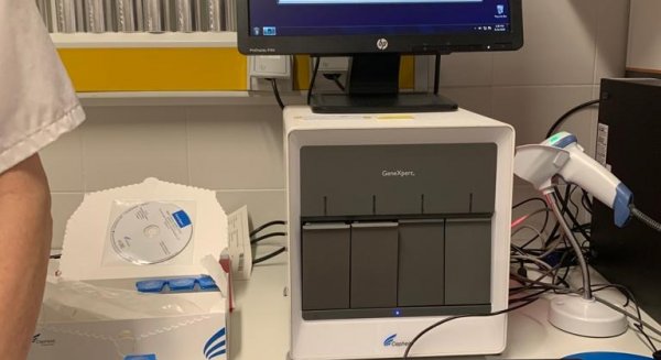 El Área Sanitaria Norte de Málaga se une a la red de centros del SAS para diagnosticar el COVID–19