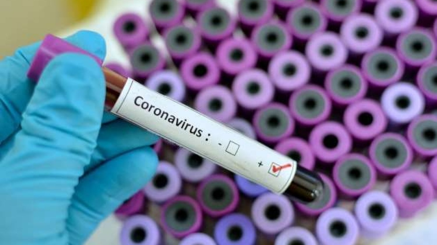 Málaga contabiliza tres nuevos contagios y un fallecido más desde ayer