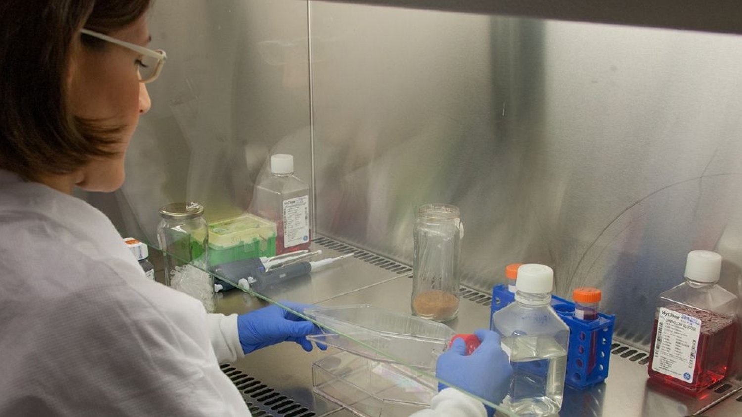 Salud inicia un ensayo clínico para probar la eficacia de Calcifediol en pacientes con COVID-19