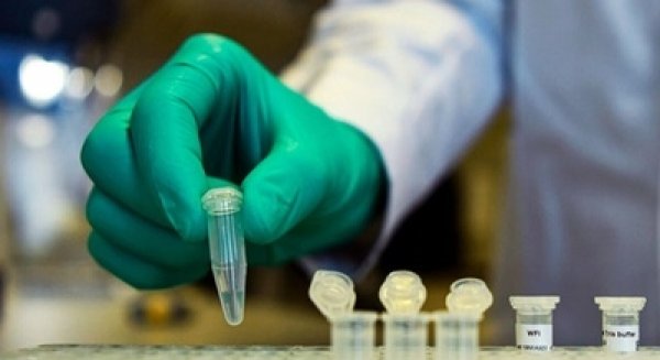 Donan 30.000 euros a la UMA para impulsar proyectos que buscan cómo frenar la pandemia del Covid-10