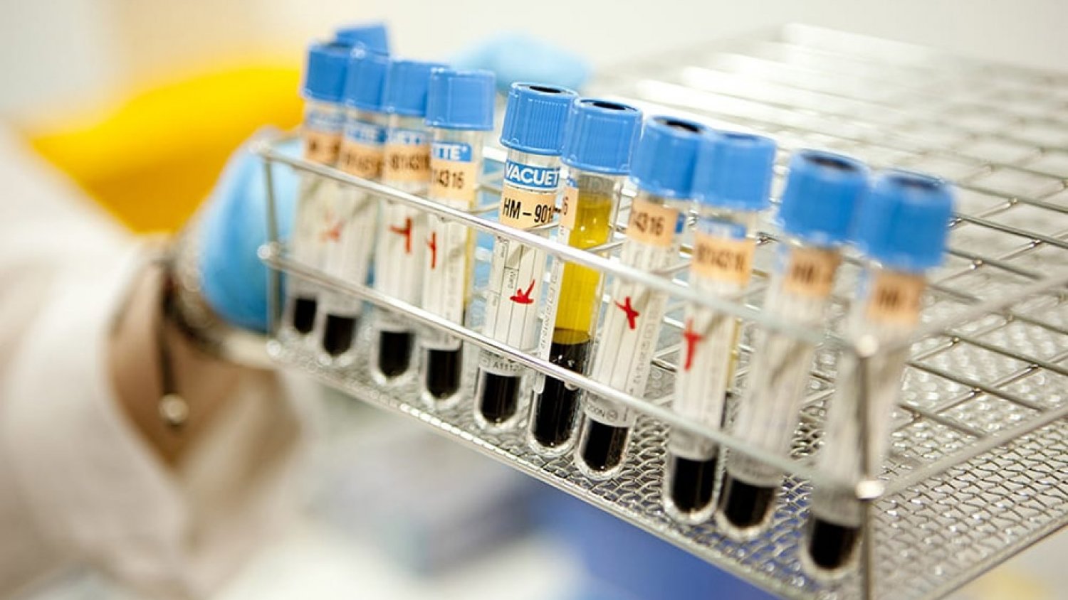 Salud y Consumo promueve la investigación en enfermedades del metabolismo