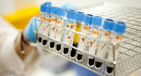 Salud y Consumo promueve la investigación en enfermedades del metabolismo