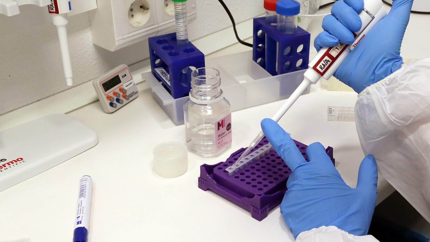 La UMA ofrece infraestructura y personal para realizar la prueba de diagnóstico del coronavirus