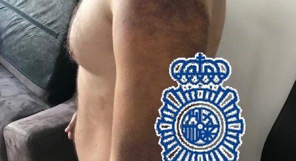 Liberada una persona que estuvo secuestrada diez días en una vivienda en Marbella