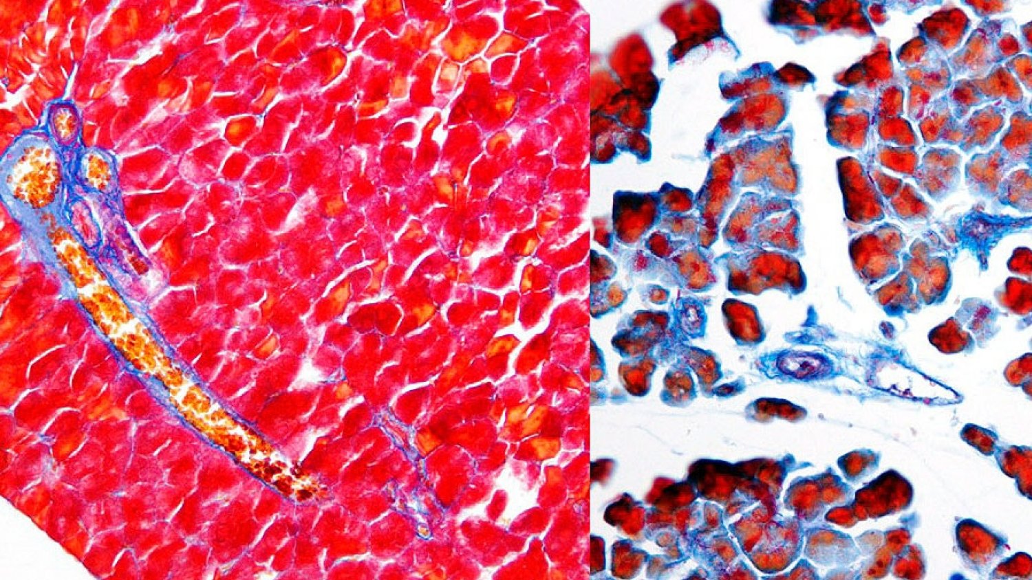 Revelan un nuevo mecanismo molecular implicado en la reparación pancreática