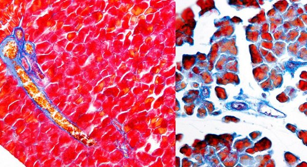 Revelan un nuevo mecanismo molecular implicado en la reparación pancreática