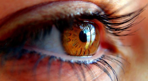 ¿Cómo afecta el Glaucoma a las mujeres?