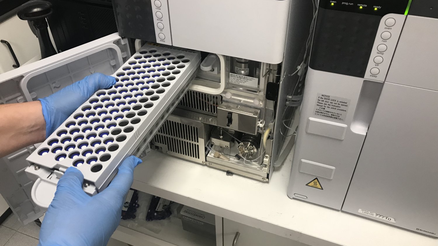 El laboratorio del Hospital Regional de Málaga unifica todas las determinaciones de inmunosupresores