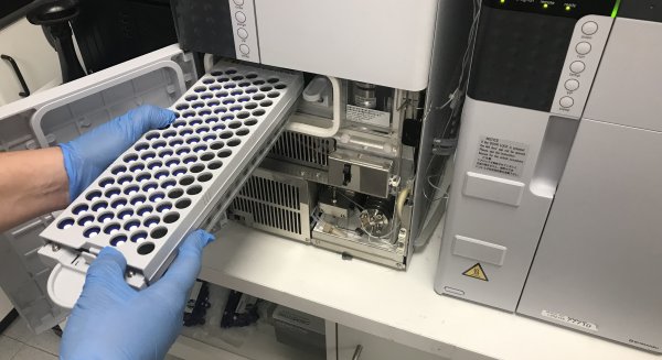 El laboratorio del Hospital Regional de Málaga unifica todas las determinaciones de inmunosupresores