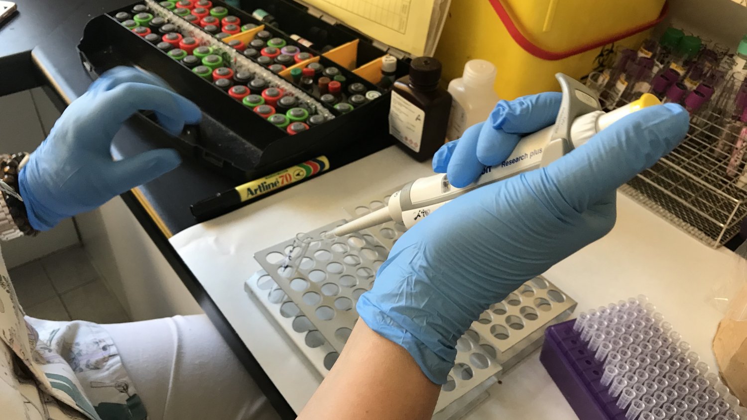 El Hospital Regional de Málaga aplica con éxito una terapia génica en pacientes