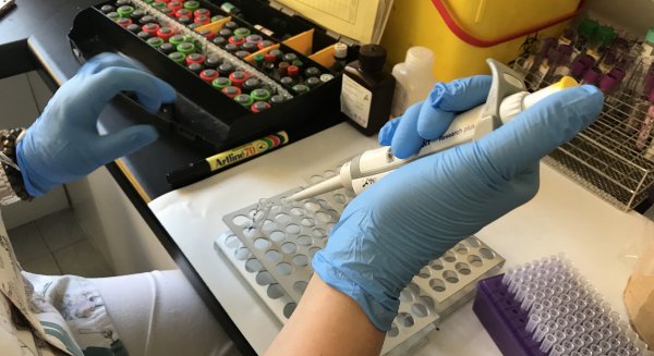 El Hospital Regional de Málaga aplica con éxito una terapia génica en pacientes