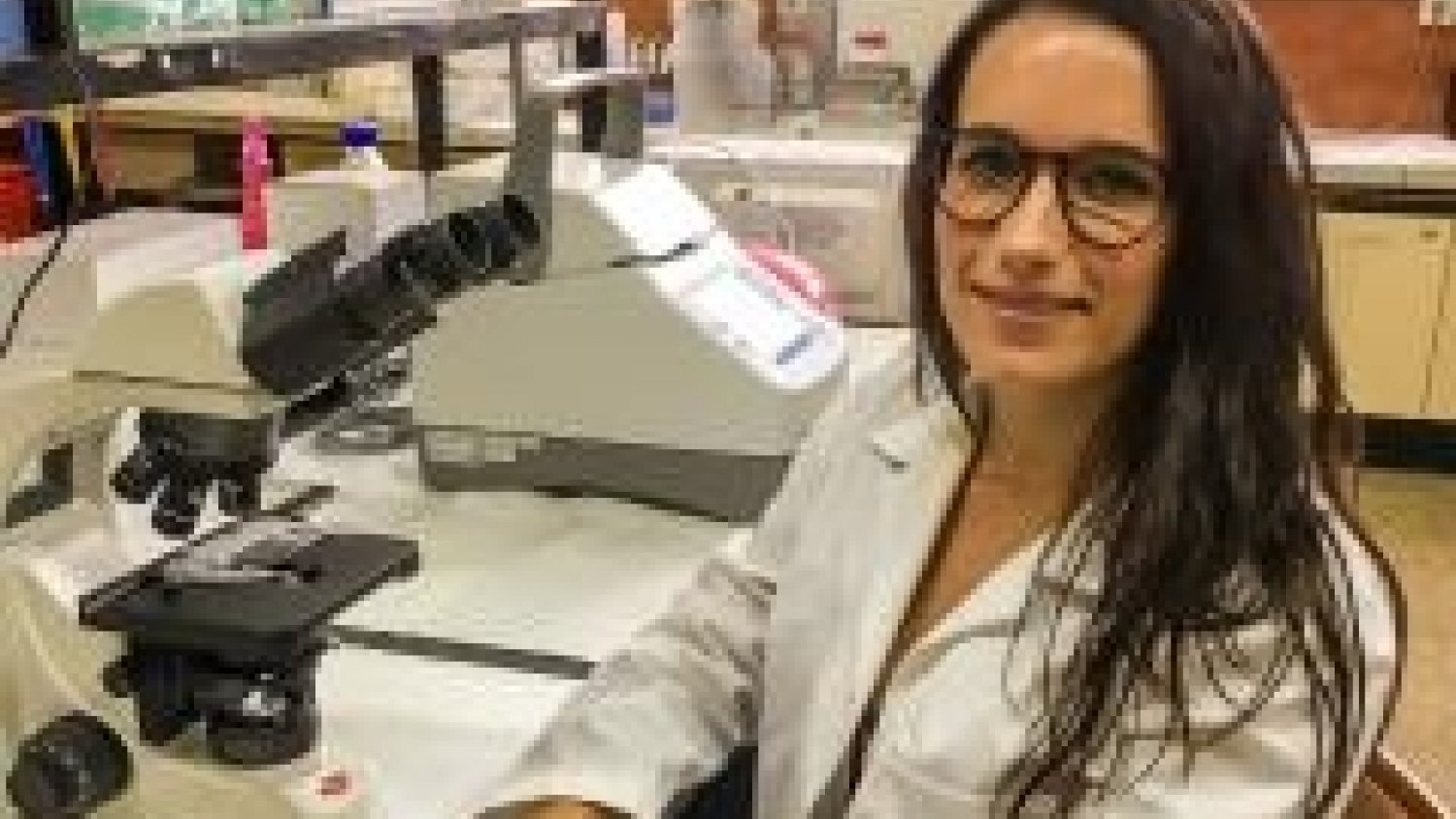 Analizan la respuesta de células astrogliales en pacientes de Alzheimer