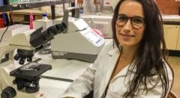 Analizan la respuesta de células astrogliales en pacientes de Alzheimer
