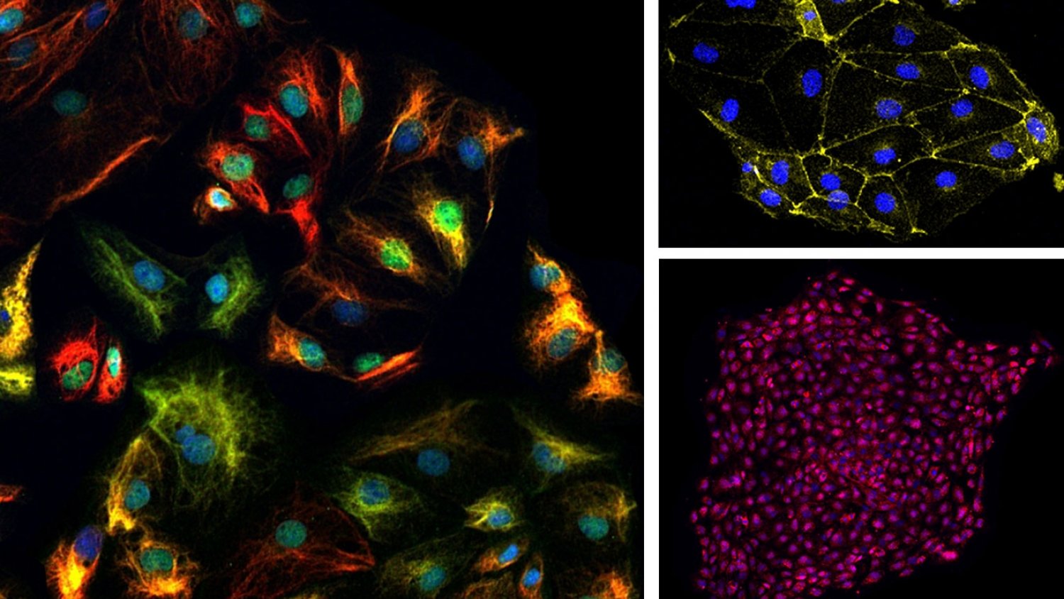 Investigadores de la UMA obtienen células epicárdicas in vitro a partir de células madre humanas