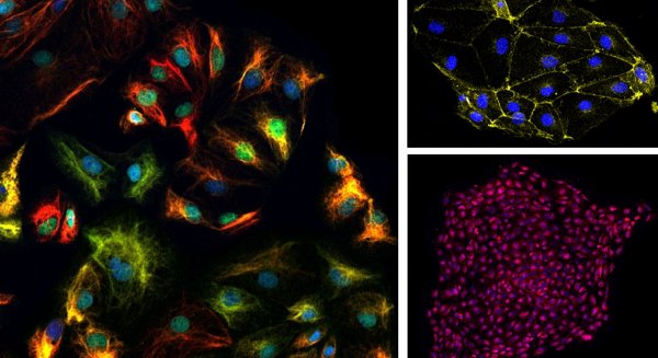 Investigadores de la UMA obtienen células epicárdicas in vitro a partir de células madre humanas