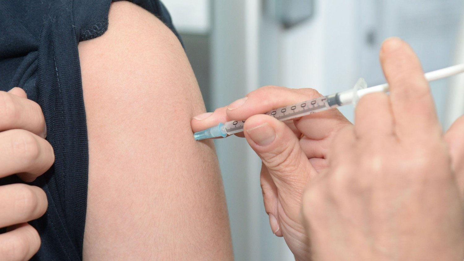 Andalucía registra 53 casos activos de viruela del mono