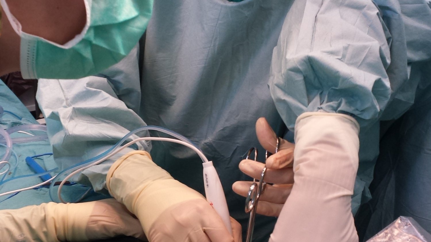 Investigan sobre la utilización de la radiofrecuencia intraoperatoria en la cirugía conservadora del cáncer de mama