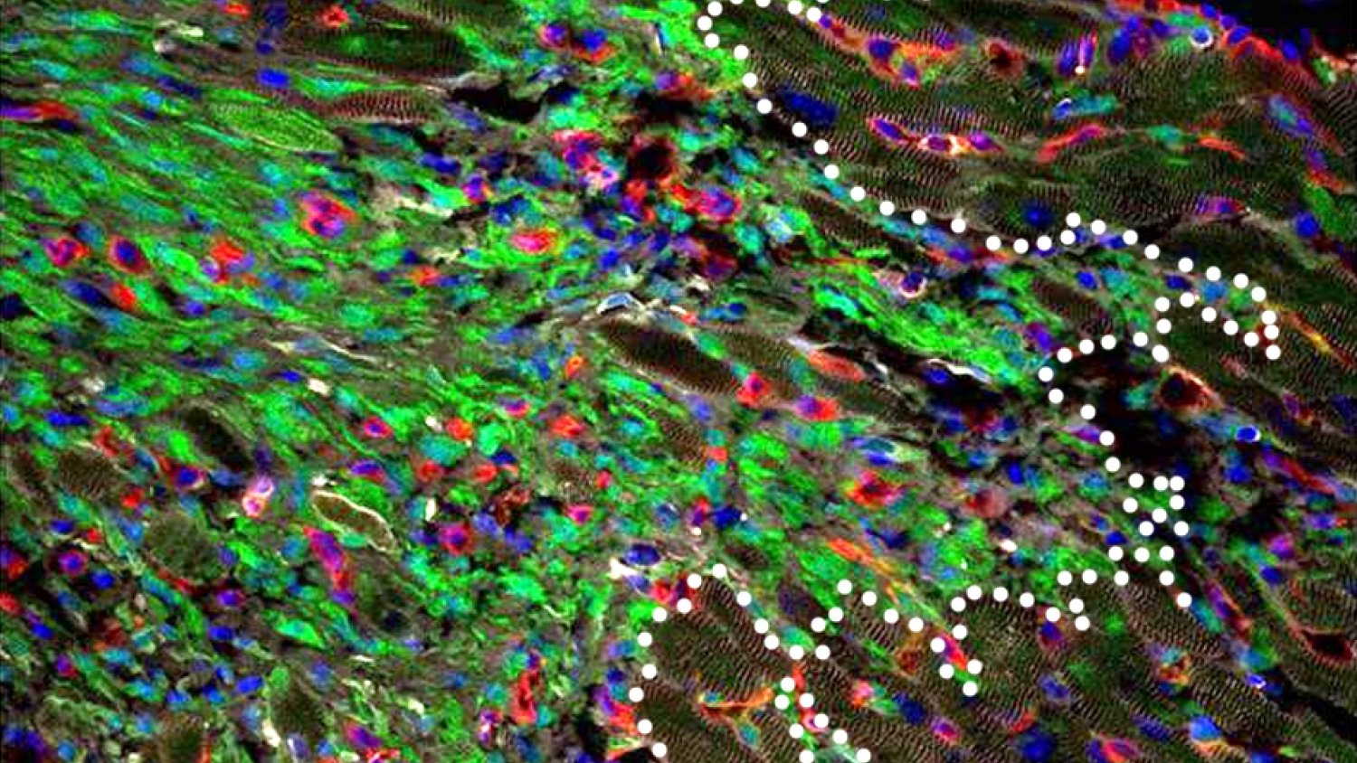 Un grupo de investigación de la UMA lidera un estudio sobre los infartos de miocardio