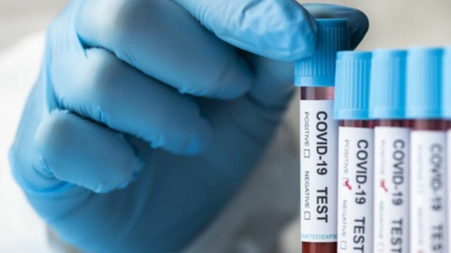 Málaga registra 134 contagios de covid-19 y ocho fallecidos