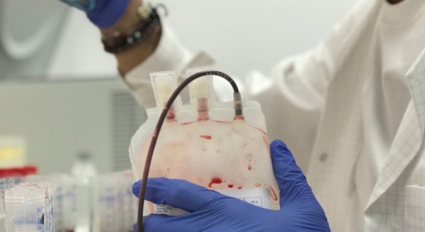 Investigadores de IBIMA desarrollan el diagnóstico de cáncer de mama con una muestra de sangre