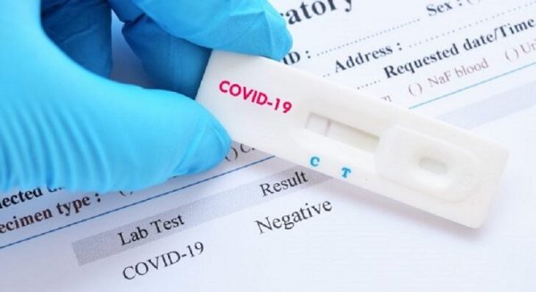 Málaga registra 253 contagios de covid-19 en una jornada con dos fallecidos