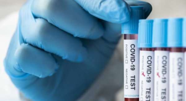 Málaga registra 269 contagios de covid-19 en una jornada con ocho fallecidos