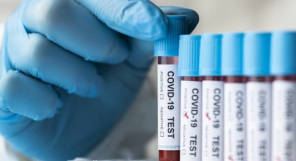 Málaga registra 388 contagios de covid-19 en una jornada con 10 fallecidos