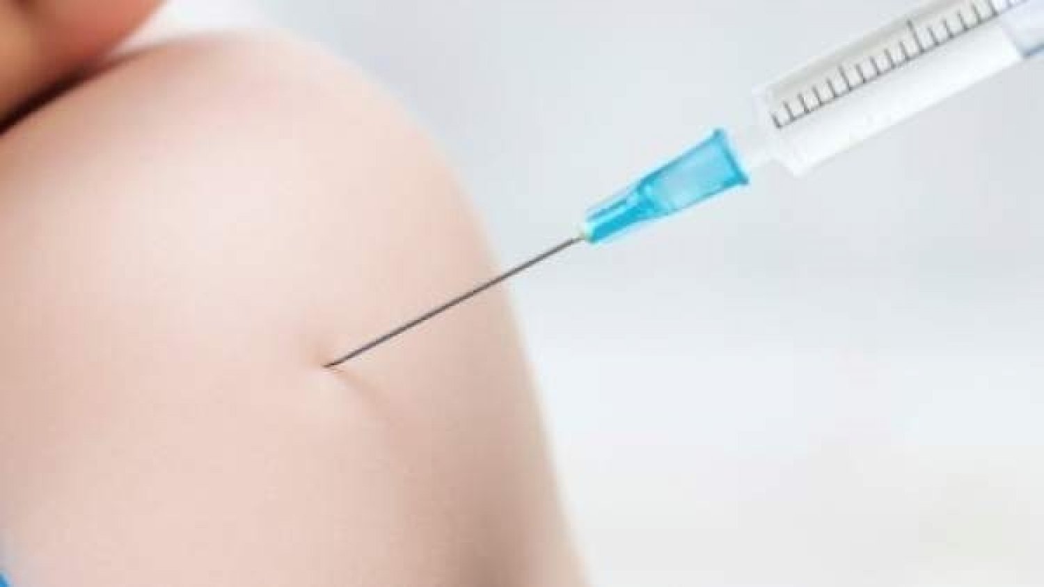 Andalucía notifica 171 casos activos de viruela del mono