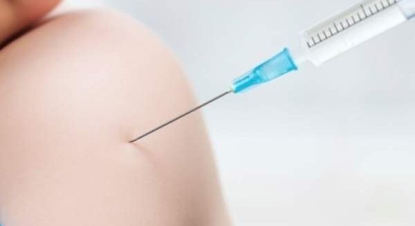 Andalucía notifica 171 casos activos de viruela del mono