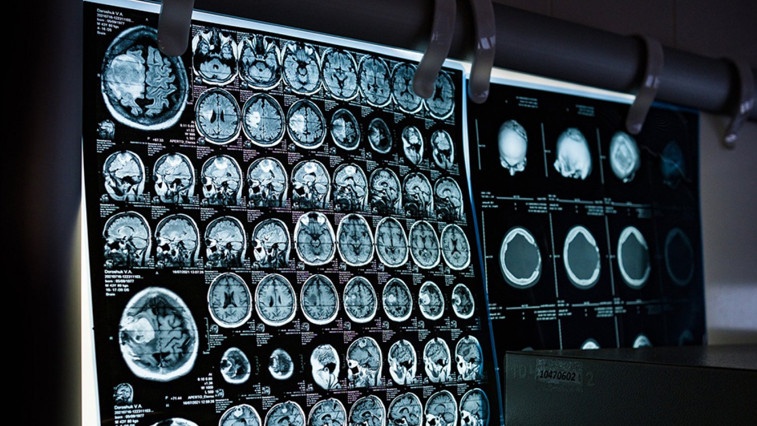 El Gobierno andaluz invierte más de 14 millones en mejorar infraestructuras de Salud Mental