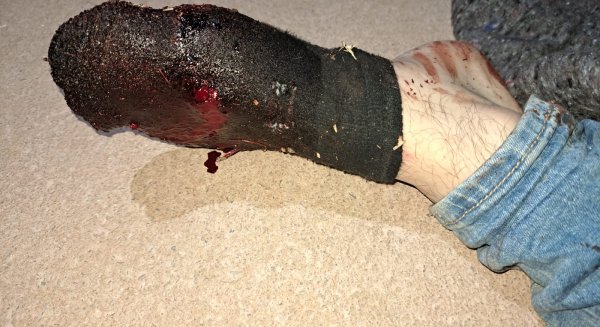 Desarticulado en Málaga un entramado de narcos que torturó a un socio por un robo