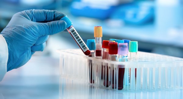 Identifican Ángulo de Fase como marcador clave en evaluación de pacientes COVID y salud nutricional infantil