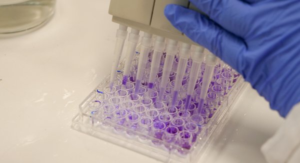 La UMA consigue cerca de 6 millones de euros de fondos para la investigación procedentes del Plan Nacional