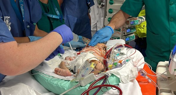 La UCI pediátrica del Hospital Materno Infantil de Málaga ha realizado 18 traslados ECMO de centros externos a lo largo de 10 años