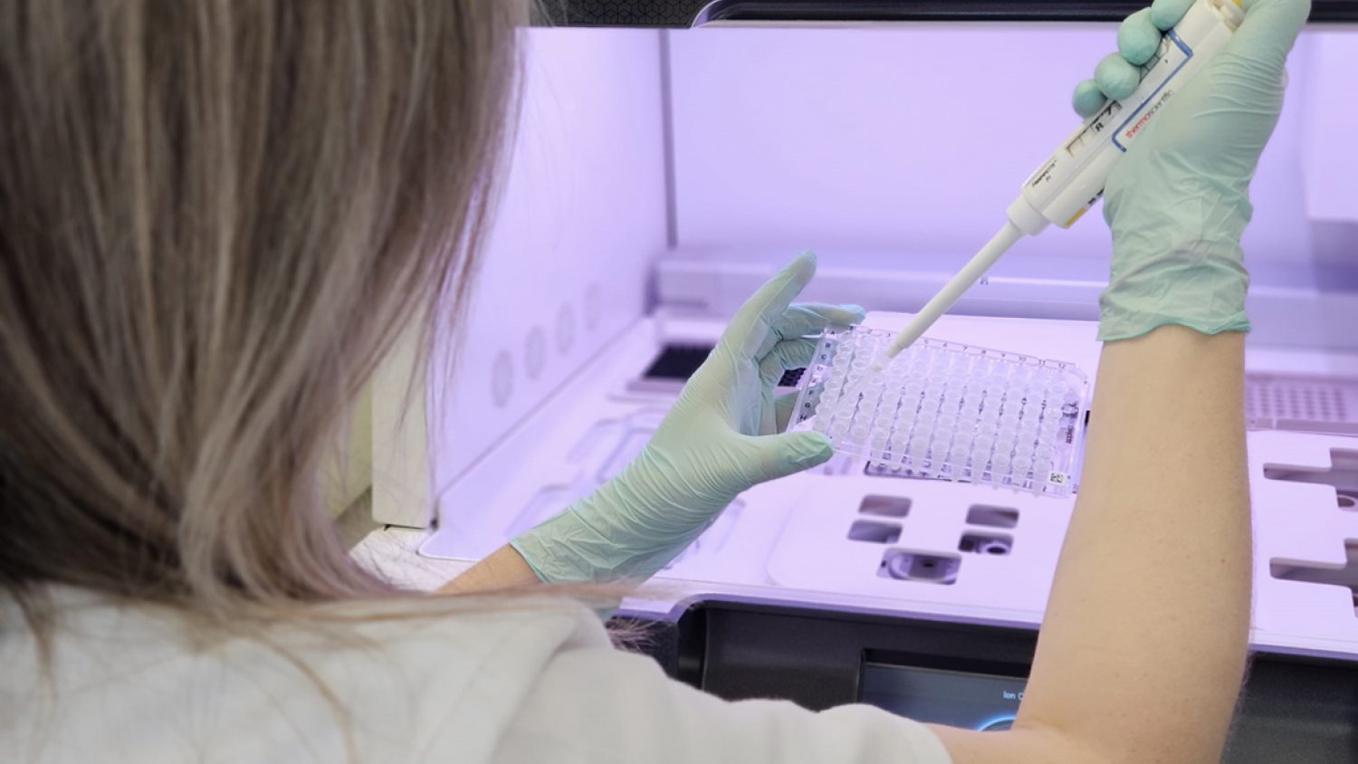 Un total de 157 pacientes pediátricos se han secuenciado a través del proyecto en el que colaboran la Fundación Unicaja y AIOM
