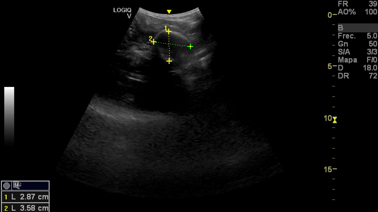 BIOPARC Fuengirola anuncia el embarazo de su hembra de perezoso