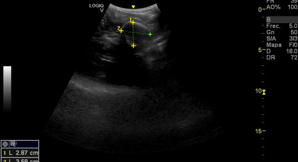 BIOPARC Fuengirola anuncia el embarazo de su hembra de perezoso