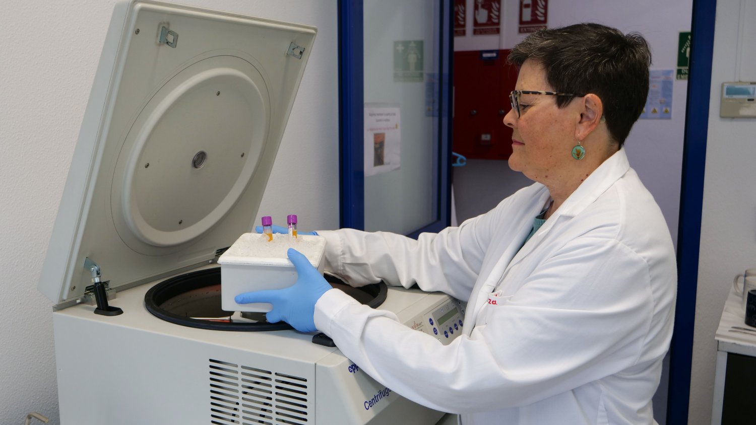 La Universidad de Málaga investiga las causas de la hipertrigliceridemia en pacientes pediátricos