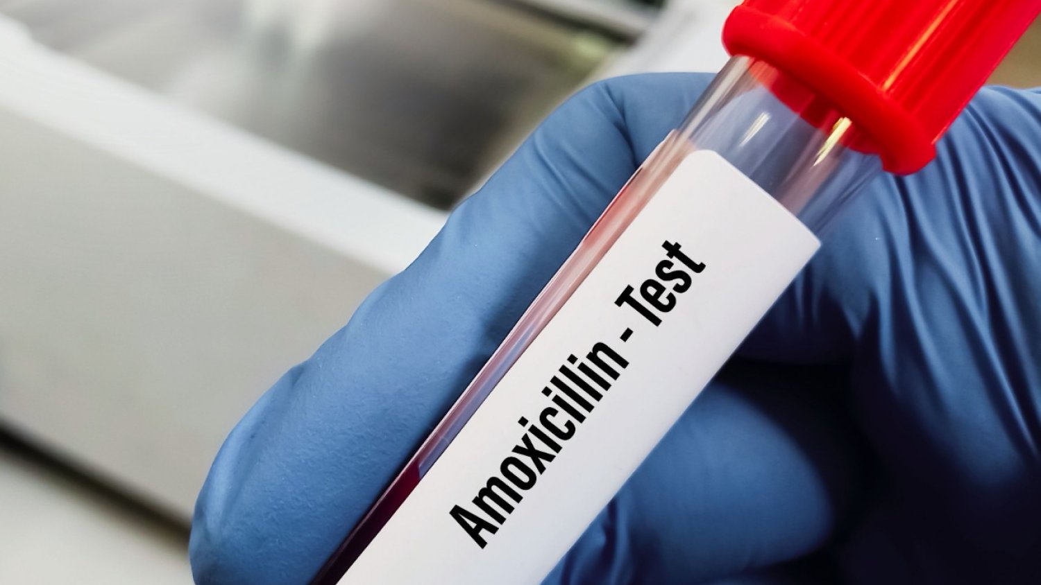 Investigadores logran detectar la alergia a la amoxicilina con mayor precisión y sin riesgo mediante nanotecnología