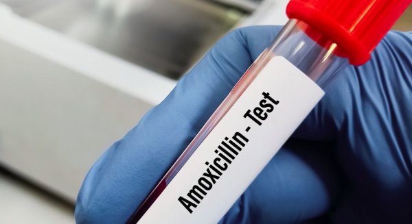 Investigadores logran detectar la alergia a la amoxicilina con mayor precisión y sin riesgo mediante nanotecnología