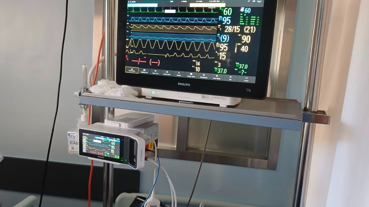 El Hospital de Antequera incluye un nuevo sistema de monitorización para pacientes críticos 