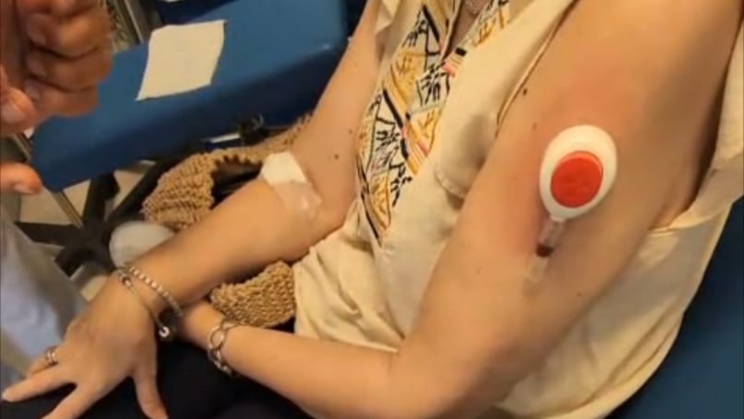 IBIMA participa en un proyecto para obtener muestras de sangre de forma menos invasiva
